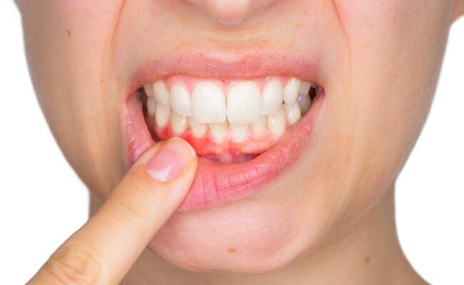 sfp dental service