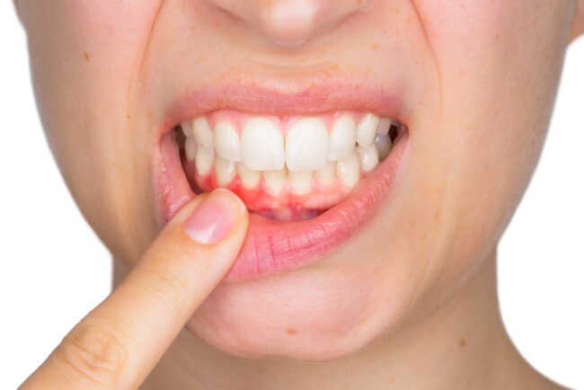 sfp dental service